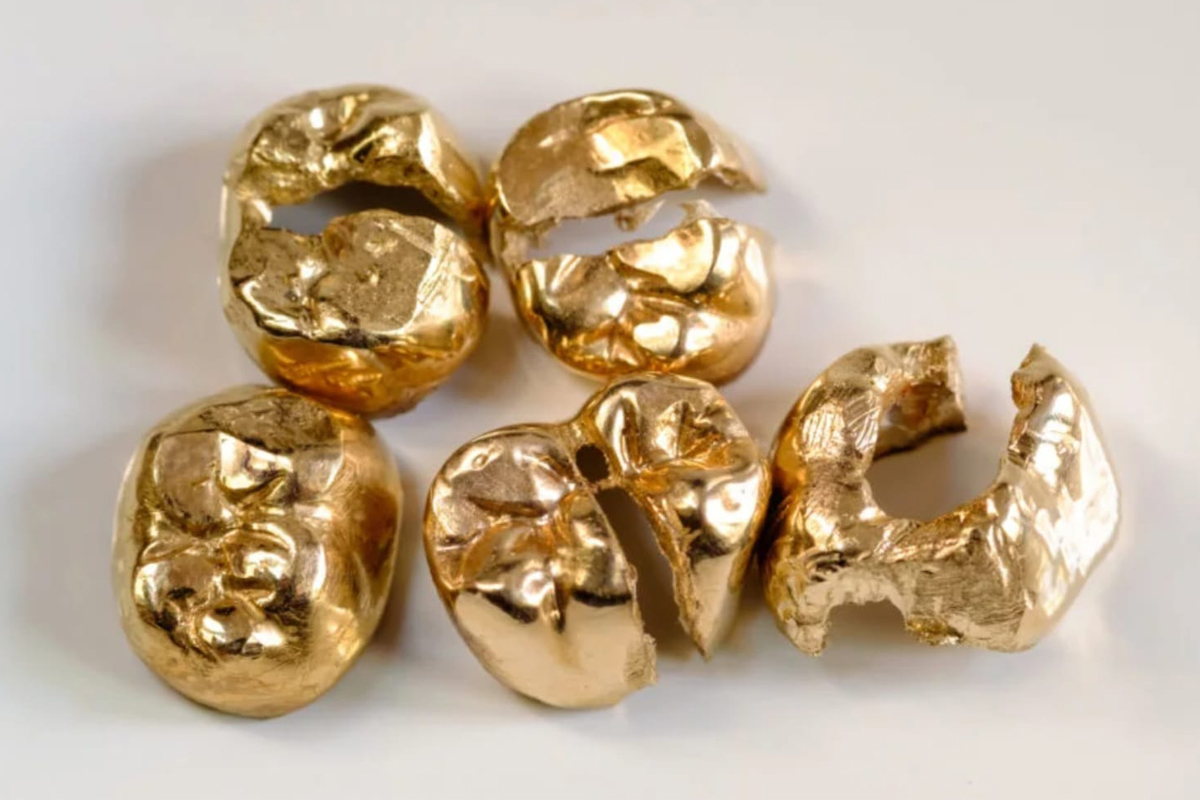 objets-en-or